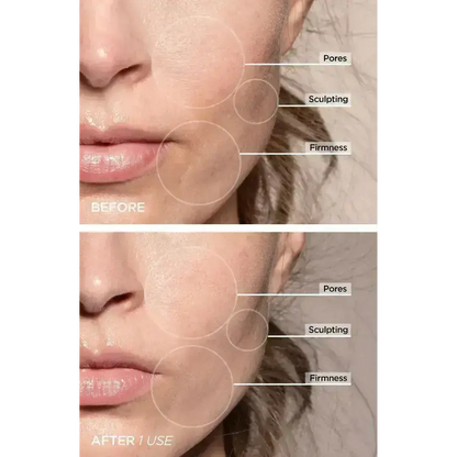 7-in-1 LED Gesichtsstraffungs- & Massagetool – Vénera